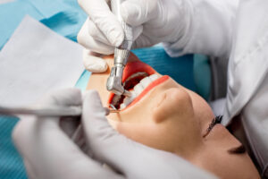 What a Teeth Cleaning Reveals About Your Overall Oral Health Before Symptoms Appear