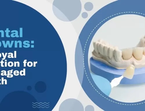 Dental Crowns: A Royal Solution for Damaged Teeth