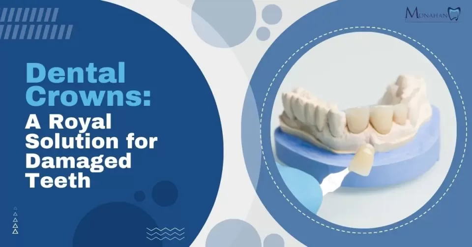 Dental Crowns: A Royal Solution for Damaged Teeth