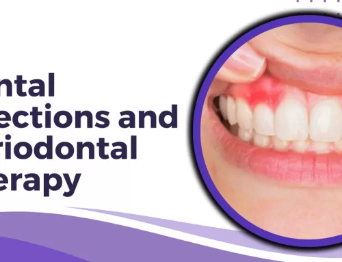 Dental Infections and Periodontal Therapy