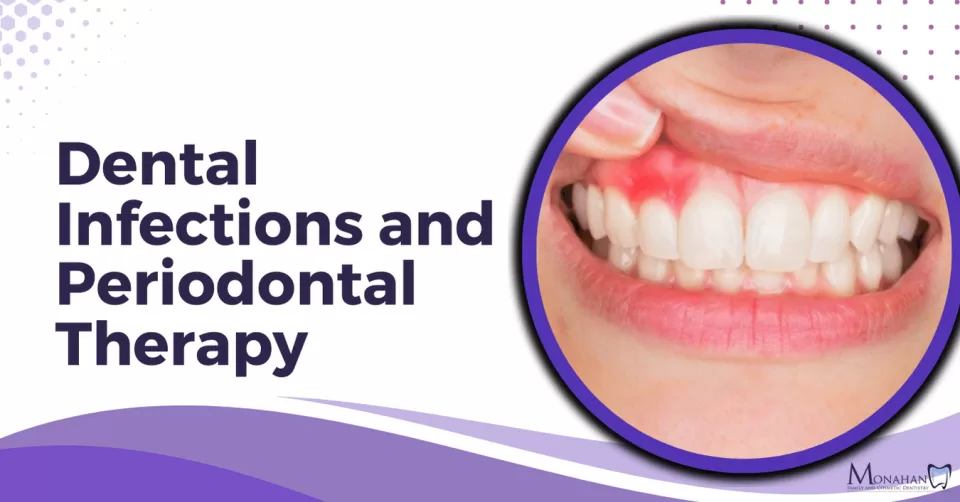 Dental Infections and Periodontal Therapy