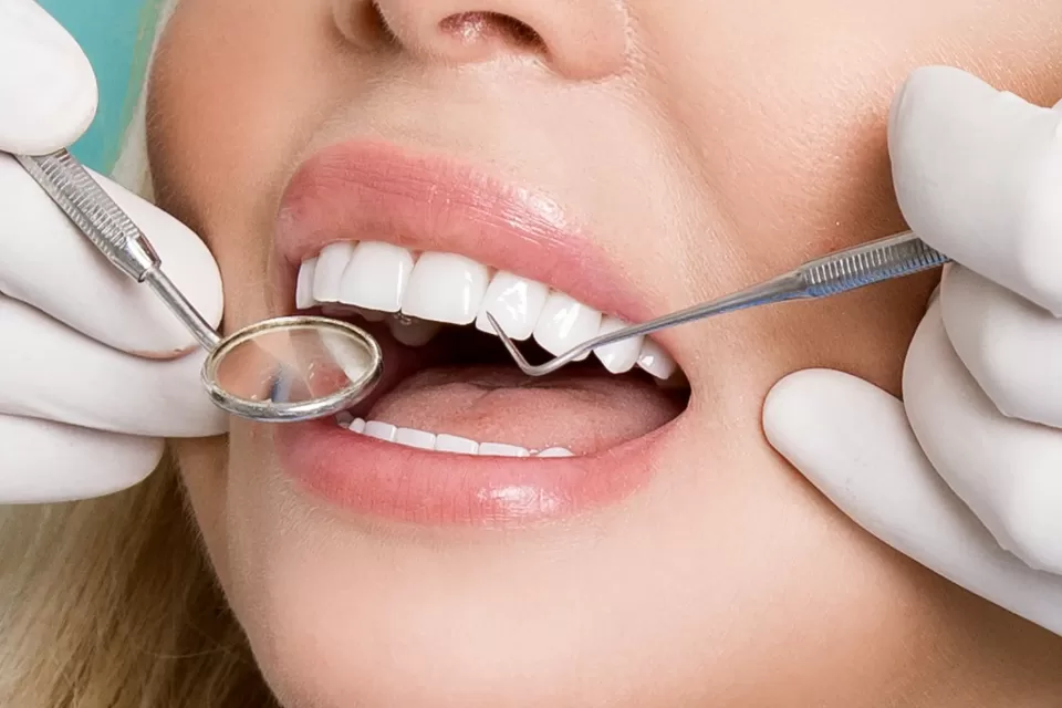 What is Dental Bonding in Cosmetic Dental Work? 