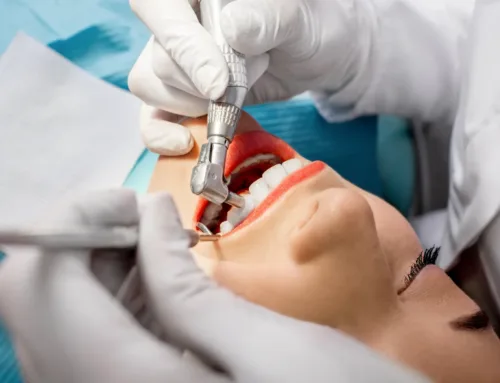 Beyond the Polish: Why Modern Teeth Cleaning Is More Than Just a Routine