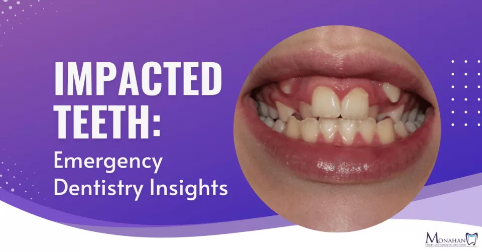 Impacted Teeth: Emergency Dentistry Insights