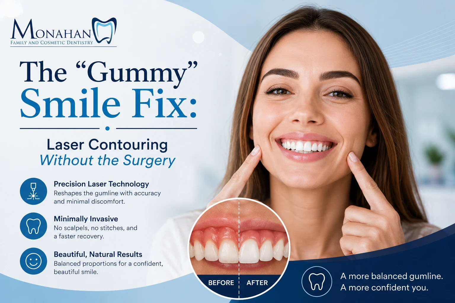 The “Gummy” Smile Fix