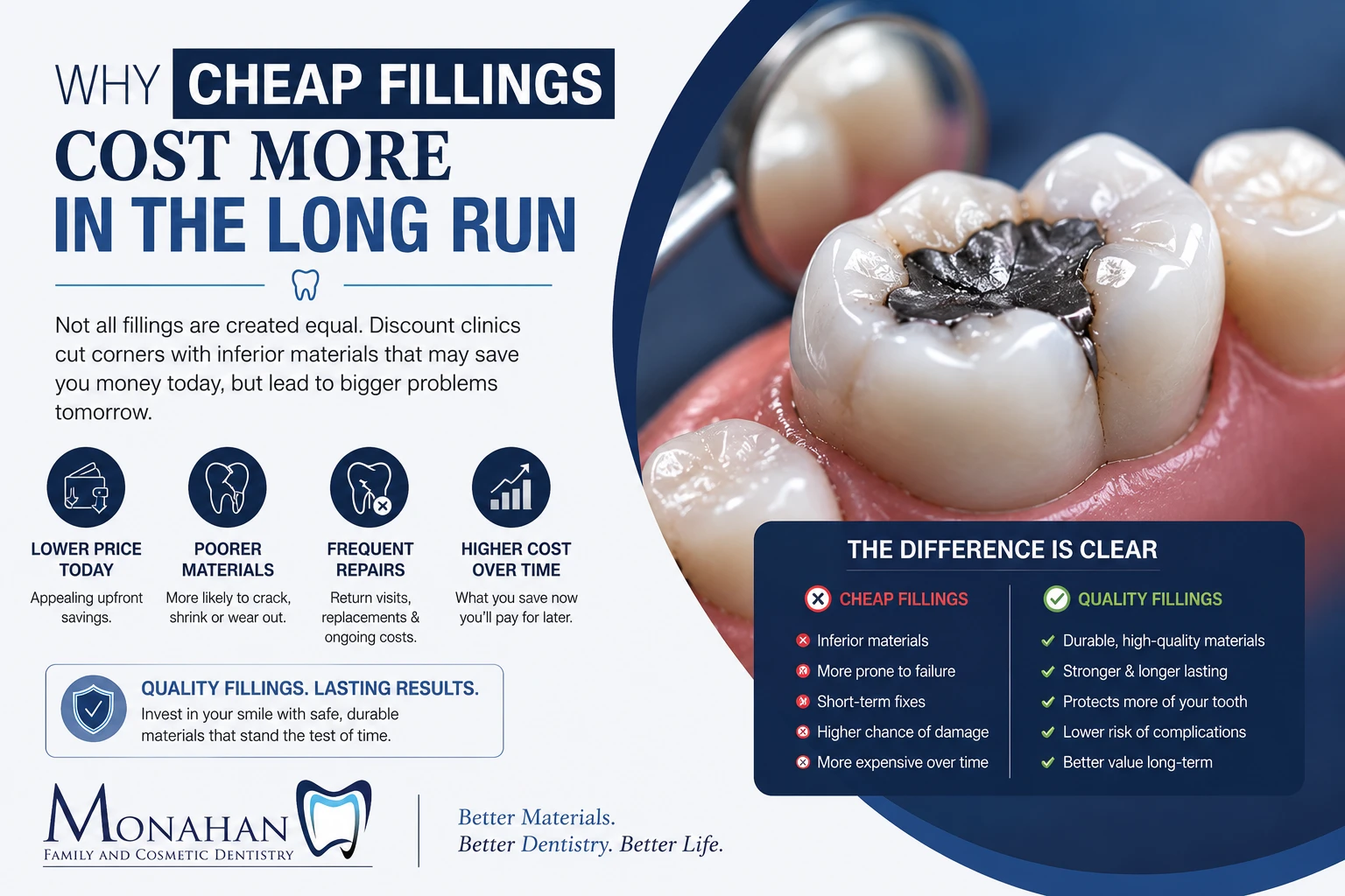 Hidden Cost” of Cheap Fillings