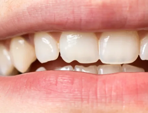 Who’s the Go-To Dental Clinic for Dental Implants in Graham, NC?