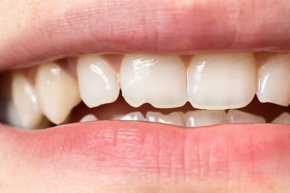 Who’s the Go-To Dental Clinic for Dental Implants in Graham, NC?