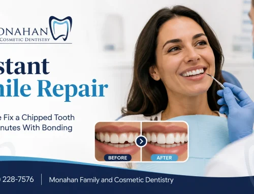 Instant Smile Repair: How We Fix a Chipped Tooth in 30 Minutes With Bonding