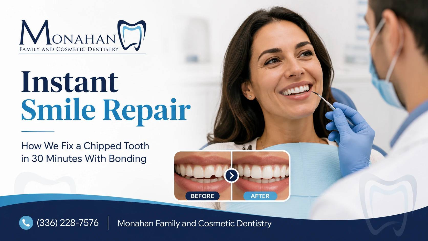 Chipped Tooth in 30 Minutes With Bonding