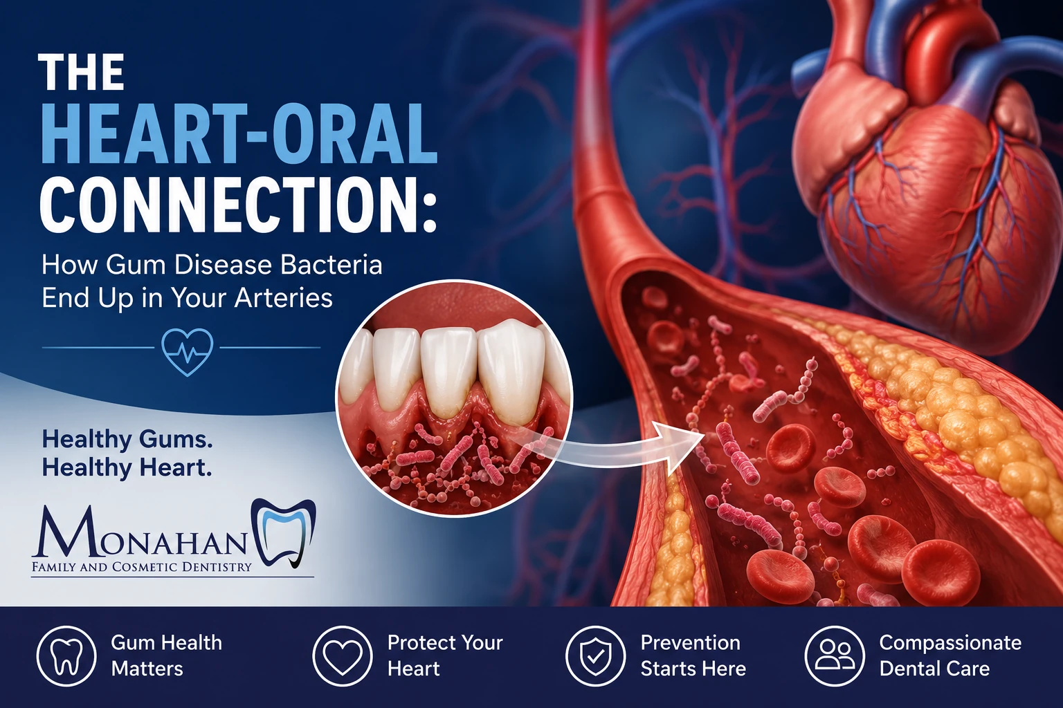 Gum Disease Bacteria